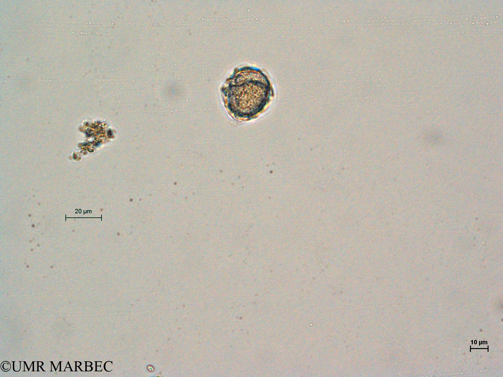 phyto/Thau_Lagoon/THAU_station1/GELAMED 2010/Protoperidinium curvipes (ancien Protoperidinium sp21 -P. pellucidum)(copy).jpg